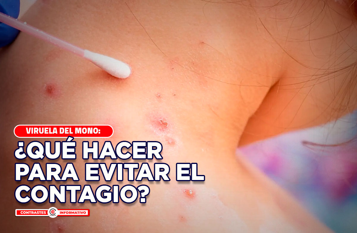 que hacer