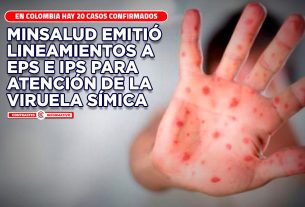 viruela simica colombia