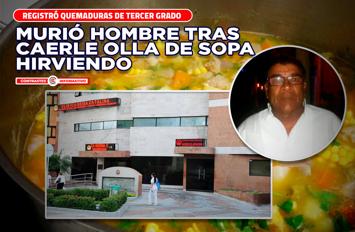 quemaduras sopa murio